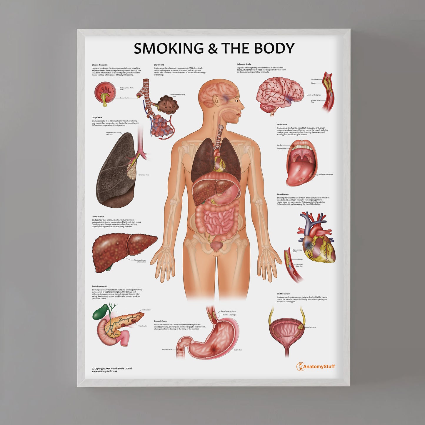 Smoking and The Body Chart / Poster